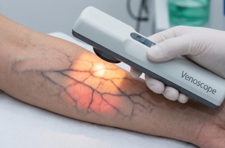 10 melhores venoscópio para comprar em 2026